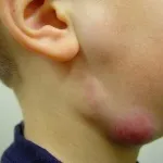 Системні захворювання крові різновиди (системні) Системні захворювання крові різновиди