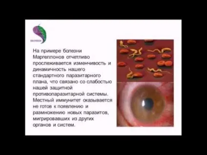 Слонова хвороба ніг причини виникнення, лікування народними средсвтамі (хвороба) Слонова хвороба ніг причини виникнення, лікування народними средсвтамі