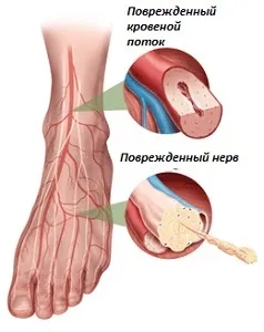 Тремор і алкоголь