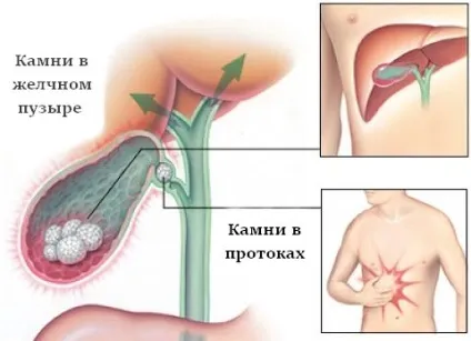 Те запор то пронос причини нестійкого стільця (нестійкого) Те запор то пронос причини нестійкого стільця