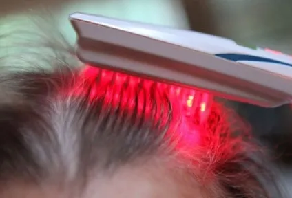 Випадання волосся у жінок причини і вирішення проблеми - сторінка 2 - настройка здоров'я (проблеми) Випадання волосся у жінок причини і вирішення проблеми - сторінка 2 - настройка здоров'я