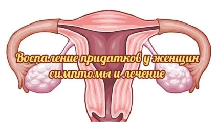 Запалення придатків симптоми і різні методи терапії (симптоми) Запалення придатків симптоми і різні методи терапії