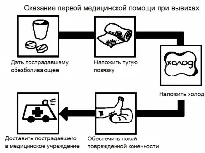 Вивих пальця на руці симптоми і лікування (руці) Вивих пальця на руці симптоми і лікування