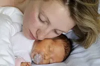 Жовтяниця наслідки у чоловіків, жінок і дітей (наслідки) Жовтяниця наслідки у чоловіків, жінок і дітей