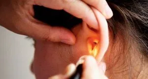 Рідина в вусі за барабанною перетинкою у дитини лікування (дитини) Рідина в вусі за барабанною перетинкою у дитини лікування