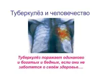 996 Презентації на тему туберкульоз на (туберкульоз) 996 Презентації на тему туберкульоз на