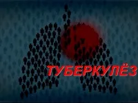 996 Презентації на тему туберкульоз на (туберкульоз) 996 Презентації на тему туберкульоз на