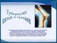 996 Презентації на тему туберкульоз на (презентації на тему туберкульоз) 996 Презентації на тему туберкульоз на