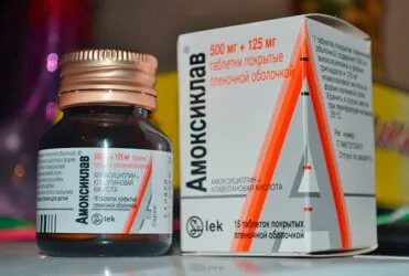 Ангіна під час вагітності