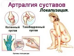 Артралгія - причини, ознаки, симптоми і лікування (лікування) Артралгія - причини, ознаки, симптоми і лікування