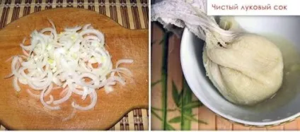 Запалення кісточки на великому пальці ноги - лікування захворювання (запалення) Запалення кісточки на великому пальці ноги - лікування захворювання
