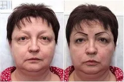 Чи боляче робити татуаж брів