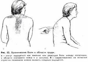 Біль в легких при кашлі чому болять легені, що робити при болю в легенях, лікування народними (кашлі) Біль в легких при кашлі чому болять легені, що робити при болю в легенях, лікування народними