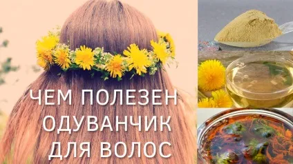 Чим корисний кульбаба для волосся