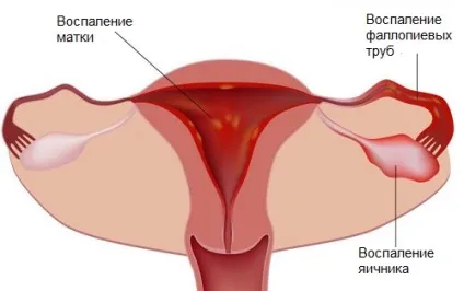 Чим небезпечна мастопатія і чому не варто відкладати її лікування (стоїть) Чим небезпечна мастопатія і чому не варто відкладати її лікування