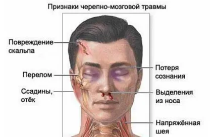 Черепно-мозкова травма - симптоми, причини, лікування і діагностика (лікування) Черепно-мозкова травма - симптоми, причини, лікування і діагностика