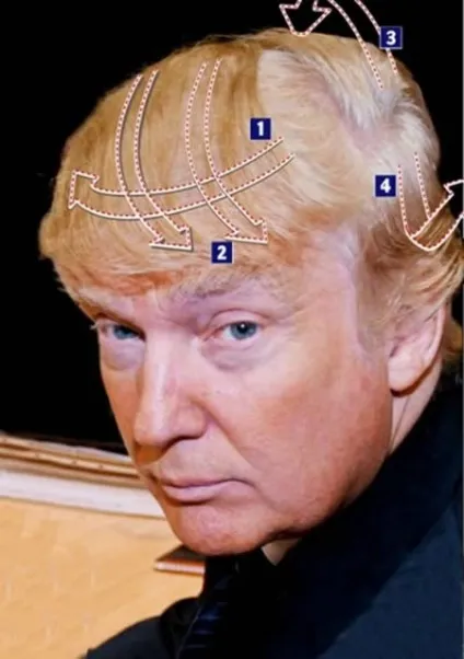 Що робити, якщо ти лисий