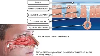 Що таке нежить чому з'являється, це хвороба чи ні (хвороба) Що таке нежить чому з'являється, це хвороба чи ні