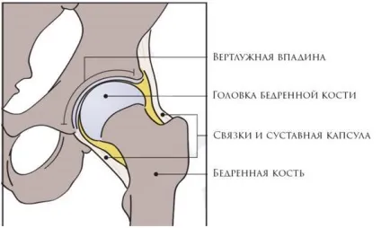 Що таке дисплазія кульшового суглоба (dammar) Що таке дисплазія кульшового суглоба