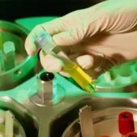 Що входить в торч-інфекції торч-інфекції у дітей (торч-інфекції) Що входить в торч-інфекції торч-інфекції у дітей