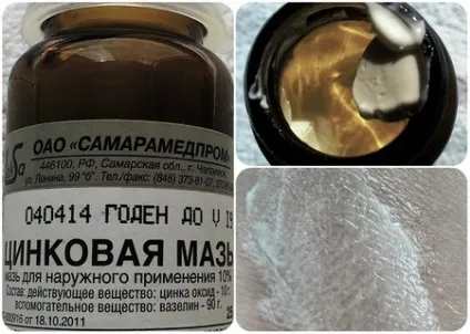 Цинкова мазь від прищів відгуки і способи застосування (цинкова мазь паста прищі застосування інструкція) Цинкова мазь від прищів відгуки і способи застосування