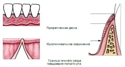 Десна - енциклопедія стоматології (стоматології) Десна - енциклопедія стоматології