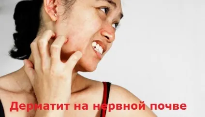 Дерматит на нервовому грунті