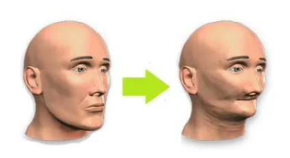 Якщо ви втратили зуб, найімовірніше, ви можете втратити наступний, стоматологічна клініка (імплантація зубів + в Одессае) Якщо ви втратили зуб, найімовірніше, ви можете втратити наступний, стоматологічна клініка
