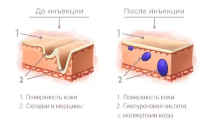 Естетична гінекологія 1 (естетична) Естетична гінекологія 1