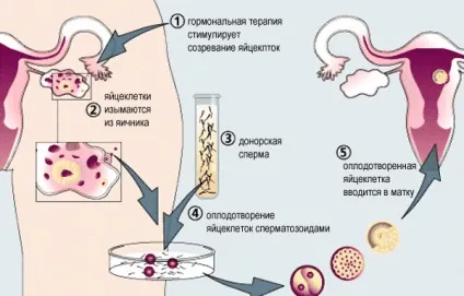 Еко наслідки для здоров'я жінки - чим небезпечно (наслідки) Еко наслідки для здоров'я жінки - чим небезпечно