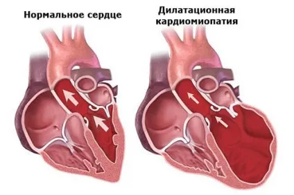 Еко наслідки для здоров'я жінки - чим небезпечно (небезпечно) Еко наслідки для здоров'я жінки - чим небезпечно