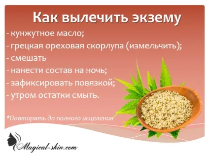 Екзема на тілі як виглядає, лікування (виглядає) Екзема на тілі як виглядає, лікування