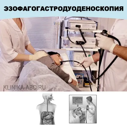 Гастроскопия і ендоскопія шлунка без болю - 3000 рублів! (Болі) Гастроскопия і ендоскопія шлунка без болю - 3000 рублів!