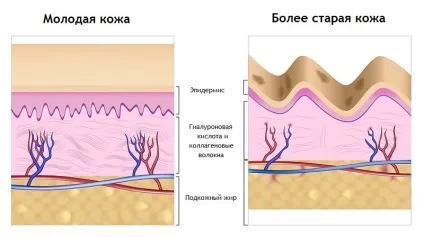 Гіалуронова кислота для обличчя - рецепти масок в домашніх умовах, що і як (масок) Гіалуронова кислота для обличчя - рецепти масок в домашніх умовах, що і як