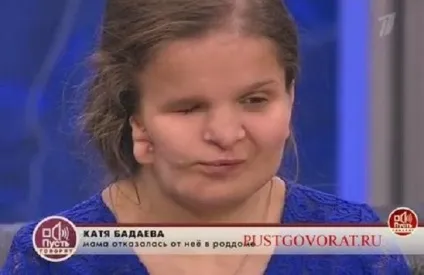 Героїня передачі «нехай говорять» 17-річна екатерина, яку кинула матір через деформованого (мати) Героїня передачі «нехай говорять» 17-річна екатерина, яку кинула матір через деформованого
