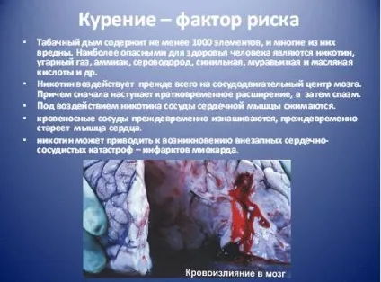 Гігієна серцево-судинної системи