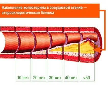Гігієна серцево-судинної системи
