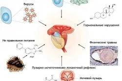 Гомеопатія для лікування простатиту у чоловіків (гомеопатія) Гомеопатія для лікування простатиту у чоловіків