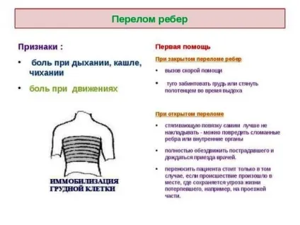 Перелом ребра, симптоми і лікування, скільки зростається, як спати, як лягає і вставати (лікування) Перелом ребра, симптоми і лікування, скільки зростається, як спати, як лягає і вставати