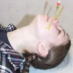 ЯМІК процедура при гаймориті, відгуки про лікування (ЯМІК) ЯМІК процедура при гаймориті, відгуки про лікування
