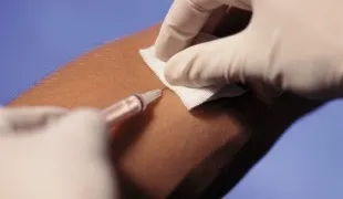 Як чистити рубець