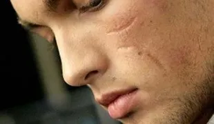 Як чистити рубець