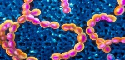 Як довго заразна ангіна при лікуванні антибіотиками, антибіотики при ангіні (лікуванні) Як довго заразна ангіна при лікуванні антибіотиками, антибіотики при ангіні
