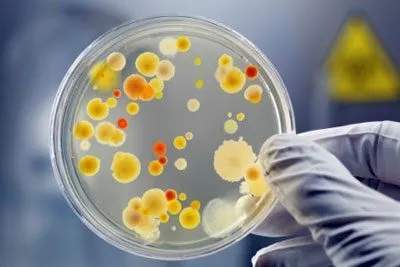 Які харчові продукти можуть викликати сальмонельоз - джерело інфекції (сальмонельоз) Які харчові продукти можуть викликати сальмонельоз - джерело інфекції
