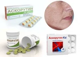 Як лікувати пігментні плями на руках (процедури) Як лікувати пігментні плями на руках