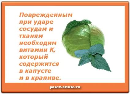 Як позбутися від синяка