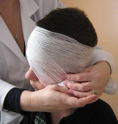 Як накласти пов'язку на одне око (очей зверху вниз) Як накласти пов'язку на одне око