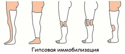 Як розпізнати і лікувати перелом пальця на нозі
