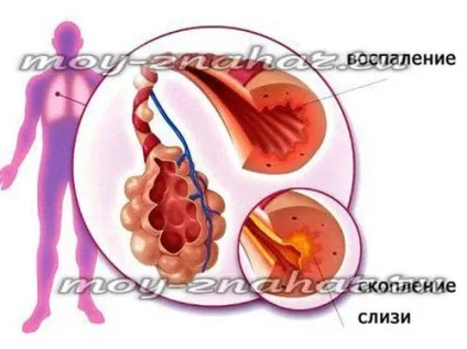 Як вивести мокроту з горла народними засобами (горла) Як вивести мокроту з горла народними засобами