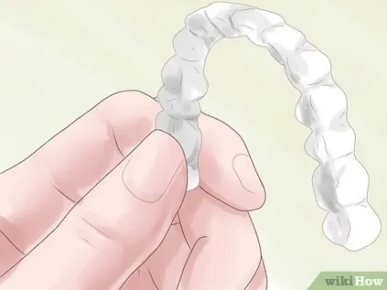 Як вирівняти зуби без брекетів, використовуючи invisalign (invisalign) Як вирівняти зуби без брекетів, використовуючи invisalign